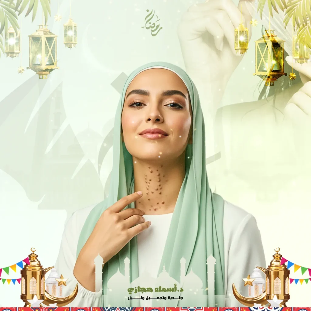 إزالة الزوائد الجلدية بالليزر لتجميل مظهرك