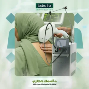 إزالة شعر الظهر بالليزر