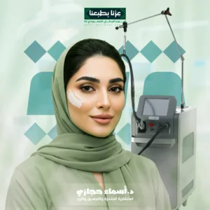 إزالة شعر الوجه بالليزر
