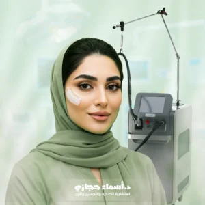 إزالة شعر الوجه بالليزر