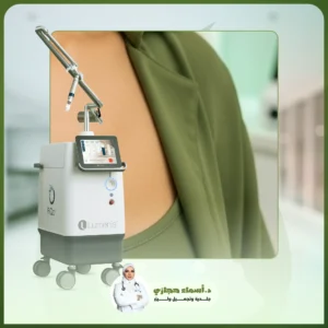 تشقير الصدر بالليزر