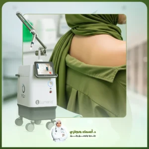 تشقير شعر الظهر بالبيكو 4
