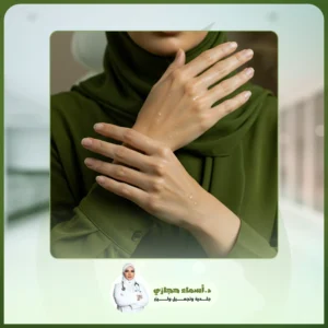 التقشير البارد لليدين