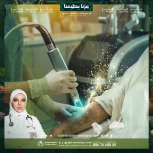عروض إزالة الكلف بالليزر الكربوني في جدة