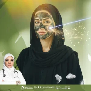 عروض إزالة الكلف بالليزر الكربوني في جدة
