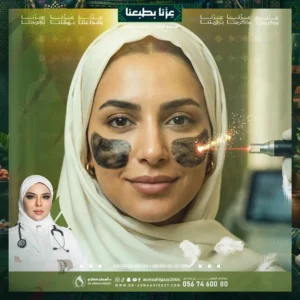 عروض ازالة التصبغات في جدة