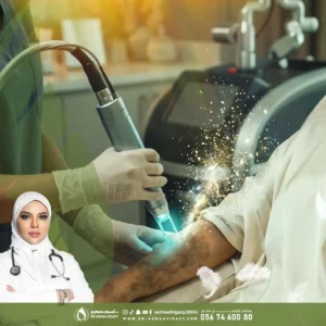 عروض ازالة التصبغات في جدة