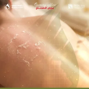 عروض التقشير البارد للظهر في جدة