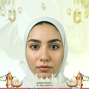 عروض الفراكشنال ليزر للمسامات في جدة (2)