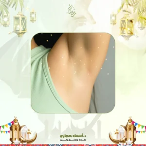 عروض الميزوثيرابي لتفتيح الاندرارم في جدة