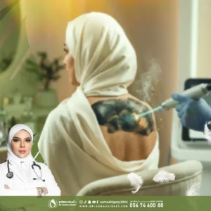 عروض تشقير الظهر بالليزر في جدة