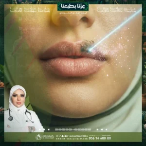عروض توريد الشفايف بالبيكو ليزر في جدة