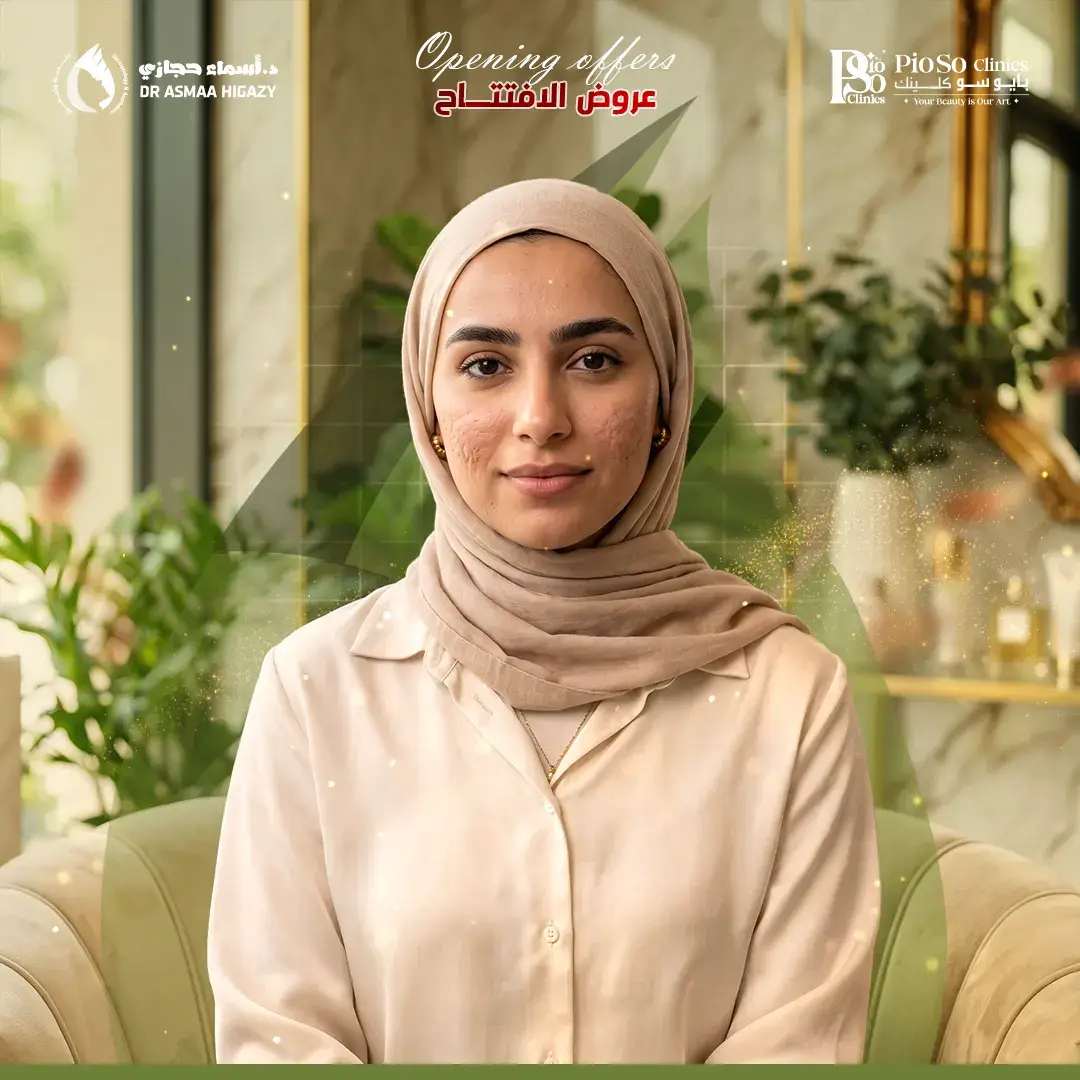عروض ليزر الفراكشنال للندبات في جدة