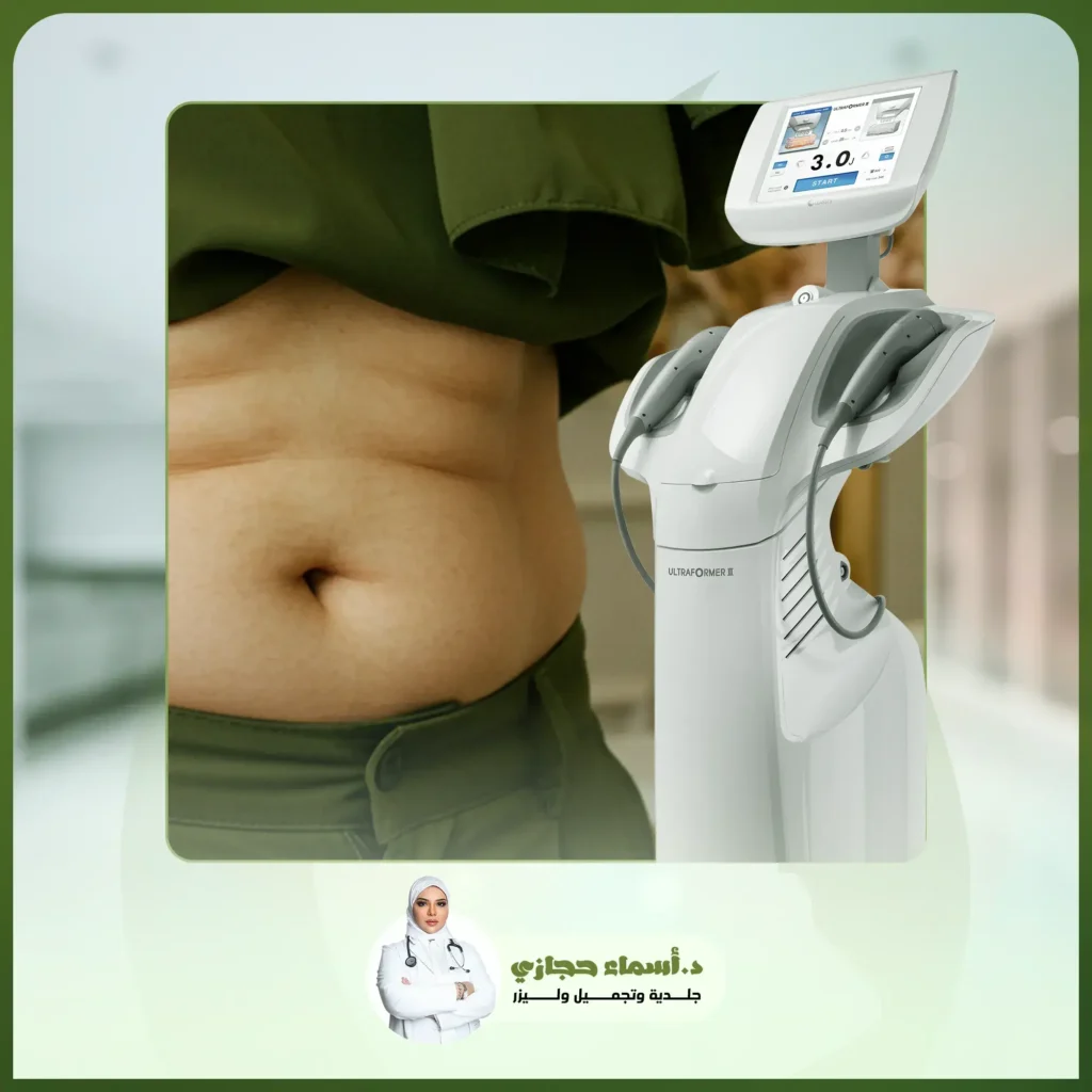 جهاز الترافورمر