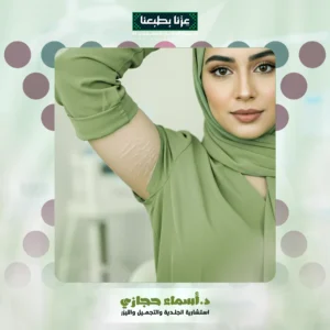 علاج الخطوط البيضاء