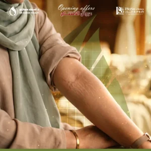 عروض علاج الخطوط البيضاء بالجسم مع د.أسماء حجازي في جدة