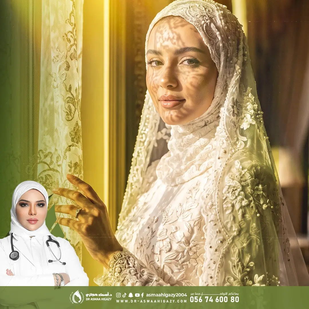 عروض تجميل العروس في جدة مع دكتورة أسماء حجازي